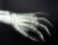 X-ray hand Royalty Free Stock Photo