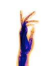 X-ray Hand