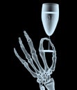 X-ray hand with glass of wine