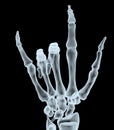 X-ray hand making offensive gesture Royalty Free Stock Photo