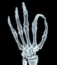 X-ray hand making ok gesture