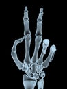 X-ray hand making victory gesture