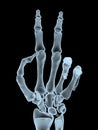 X-ray hand making victory gesture Royalty Free Stock Photo
