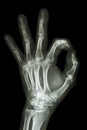 X-ray hand with OK symbol Royalty Free Stock Photo