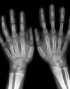 X-ray hands Royalty Free Stock Photo