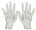X-Ray Hands 1
