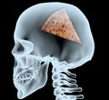 X-ray of a head with the pizza instead of the brain Royalty Free Stock Photo