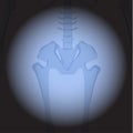 X ray hips. Royalty Free Stock Photo
