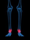 X-Ray of Human ankle