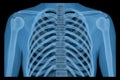 X-ray of the human chest, the concept of preventive examination, treatment of injuries, lung diseases