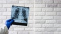 X-ray of the human chest in the hands of a doctor, X-ray of the lungs. The doctor diagnoses pneumonia of the lungs. A doctor check Royalty Free Stock Photo