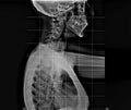 X-ray of human chest and spinal column, side view Royalty Free Stock Photo