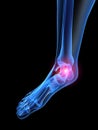 X-ray human foot Royalty Free Stock Photo