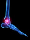 X-ray human foot