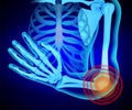 X-ray of the human hand. Anatomy of the shoulder girdle and arm.