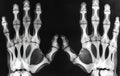 X-ray of human hands displaying intricate bone structure and joint alignment on a clear background Royalty Free Stock Photo