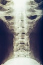 X-ray of human neck, vertebra or spine Royalty Free Stock Photo