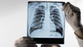 X-ray of the human lungs on an abel background respiratory disease a doctor in the clinic with an X-ray of the lungs