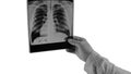 X-ray of human lungs isolated on white, in the hands of a doctor a picture of the lungs, pneumonia Royalty Free Stock Photo