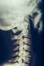 X-ray of human neck, vertebra or spine Royalty Free Stock Photo