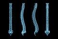 X-Ray human spinal column or backbone or spine from various angles isolated on black background 3D render illustration. Medical