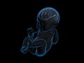 x-ray image of baby with a brain inside. Royalty Free Stock Photo