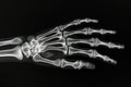 X-ray Image bones of human hand on black background Royalty Free Stock Photo