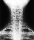 X-ray image of cervical vertebrae