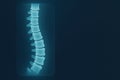 An X-ray Image Demonstrating the Structure and Segmentation of a Human Spine Royalty Free Stock Photo