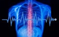 x-ray image and EKG line