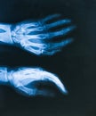 X ray Image hands Royalty Free Stock Photo
