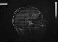 X-ray image of a head