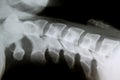 X-Ray image of healthy regular cervical spine negative results Royalty Free Stock Photo