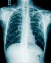 X-ray image of human abdomen, picture of human spine Royalty Free Stock Photo