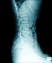 X-ray image of human abdomen, picture of human spine