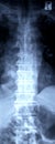 X-ray image of a human adult backbone Royalty Free Stock Photo