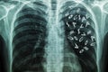 X-Ray Image Of Human Chest with English letter `Social`.