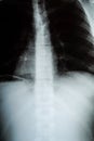 X-Ray Image Of Human Chest for a medical exam Royalty Free Stock Photo