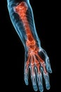 X-ray image of human forearm showing highlighted bones and joints anatomy Royalty Free Stock Photo
