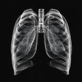 X-ray image of human lung organs on black background. Royalty Free Stock Photo