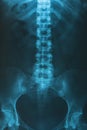 X-Ray image of human for a medical diagnosis Royalty Free Stock Photo