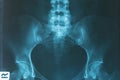 X-Ray image of human for a medical diagnosis Royalty Free Stock Photo