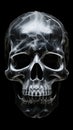X-ray Image of a Human Skull on Black Background Royalty Free Stock Photo