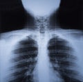 X ray image of human thorax Royalty Free Stock Photo