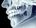 X-ray image of a jaw with teeth