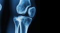 X-ray image of the knee anatomy and joint structures