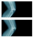 x-ray image knee joint Royalty Free Stock Photo