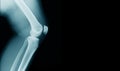 X-ray image knee joint with banner design Royalty Free Stock Photo