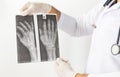 X-Ray image of human hands,Doctor examining a lung radiography, Doctor looking chest x-ray film,Anatomy. Royalty Free Stock Photo