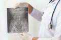 X-ray image of LS spine, AP view, show ankylosing spondylitis lumbar, Doctor examining a lung radiography, Doctor looking chest x- Royalty Free Stock Photo